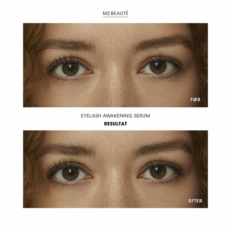 M2 BEAUTÉ Eyelash Awakening Serum 4 Ml - Billede 10