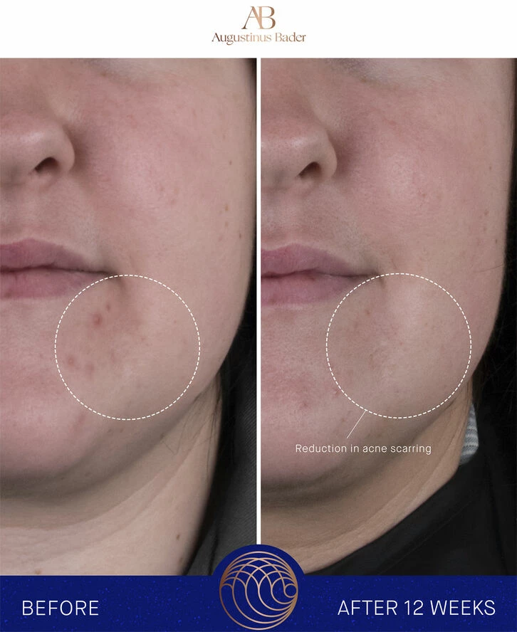 Augustinus Bader The Rich Cream - Billede 11