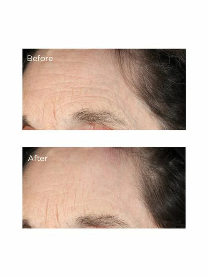 Perricone MD Essential Fx Acyl-Glutathione: Deep Crease Serum - Billede 5