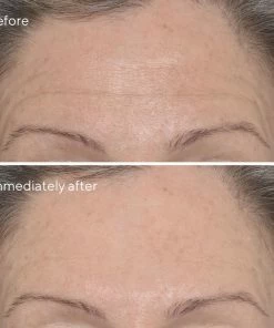 Murad Targeted Wrinkle Corrector -Clinique Store 767332603919 1
